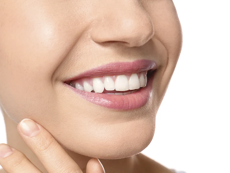 Sonrisa con blanqueamiento dental