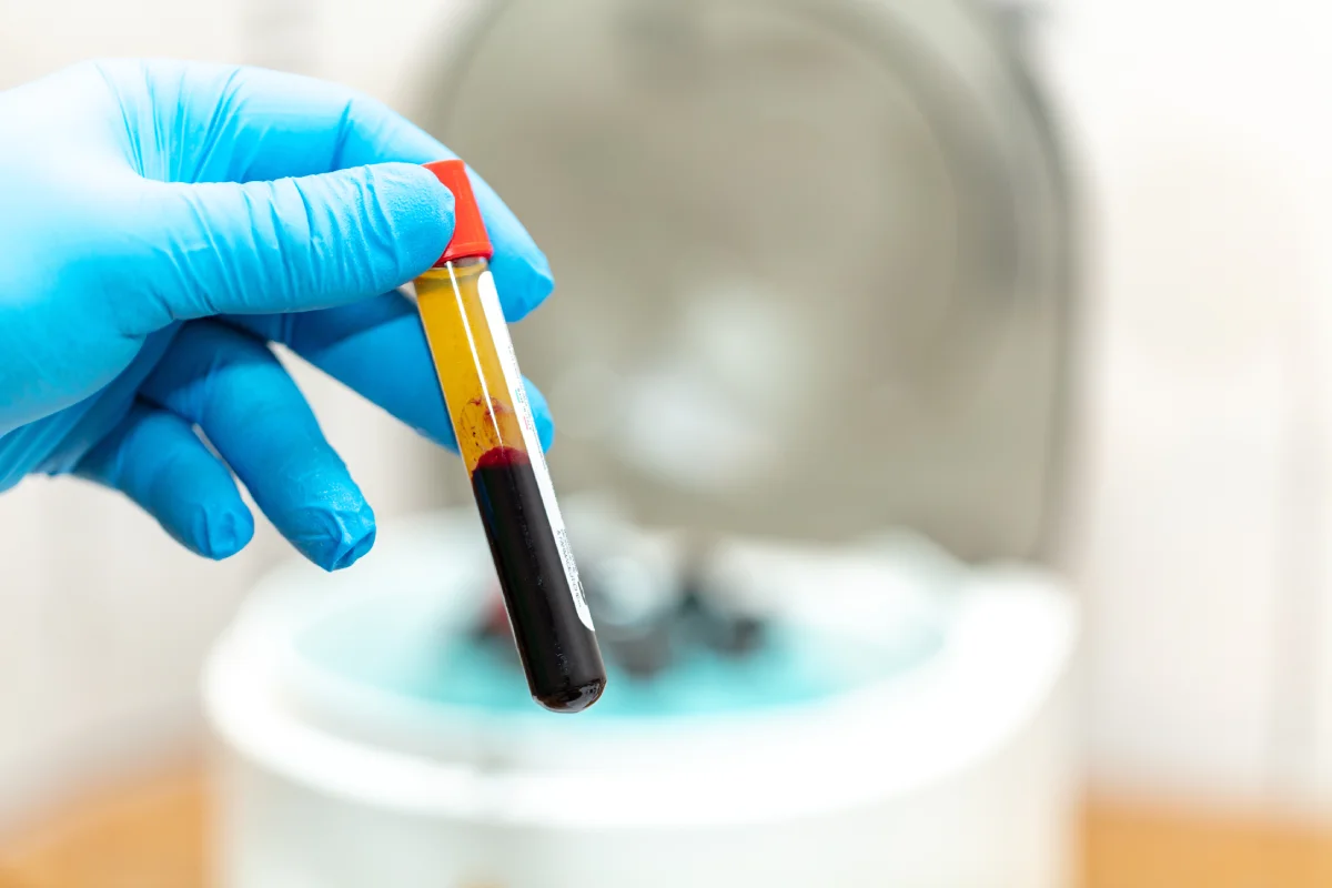 Plasma rico en factores de crecimiento