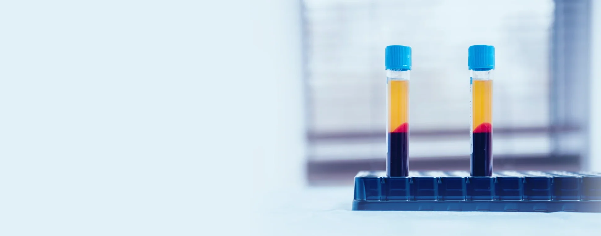 Plasma rico en factores de crecimiento