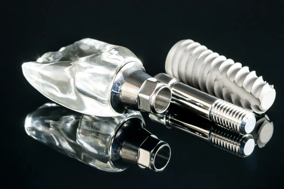 Tipos de implantes dentales