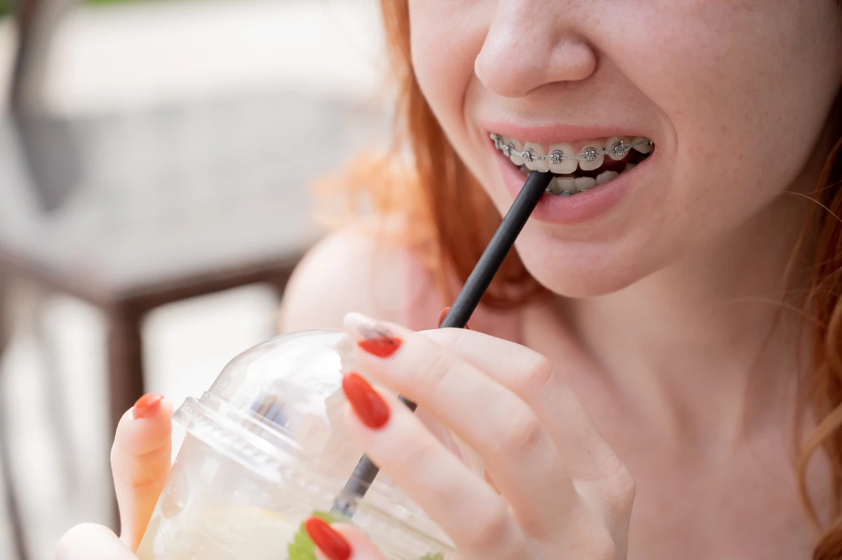 Alimentación con brackets metálicos